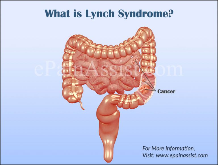 Lynch Syndrome: Causes, Symptoms, Treatment, Diagnosis, Epidemioogy, Pathophsiology