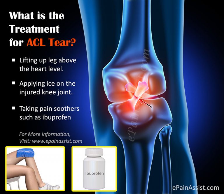 Treatment for ACL Tear: Surgery, Post Operative Rehab, Recovery