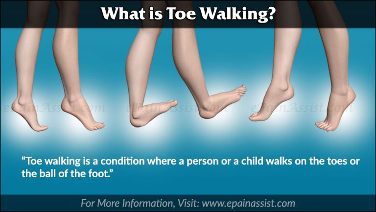 Toe Walking: Causes, Treatment, Exercises