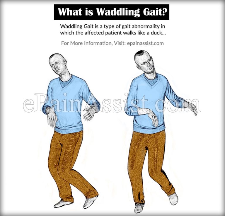 What is Waddling Gait: Causes, Treatment, Diagnosis, Yoga