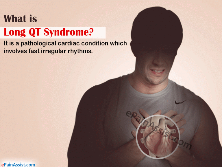 Long QT Syndrome: Causes, Symptoms, Treatment