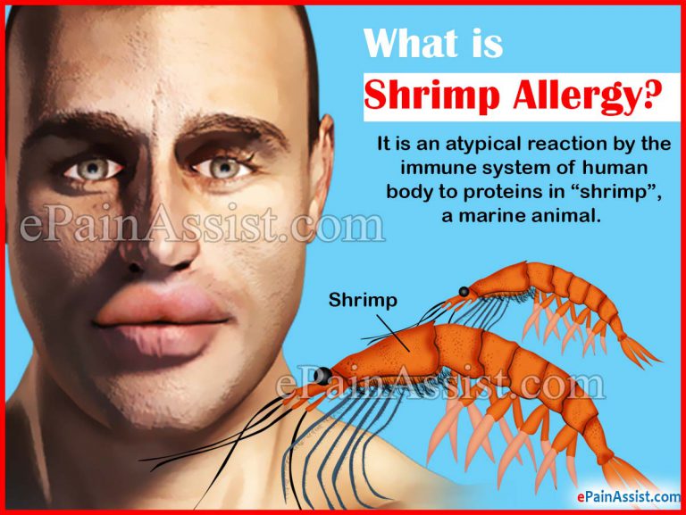 What is Shrimp Allergy, Know its Causes, Signs, Symptoms & Diagnosis