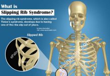 Rib Cartilage Injury: Treatment|Causes|Symptoms|Diagnosis