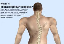Latissimus Dorsi Pain|Symptoms|Causes|Treatment|Prevention Latissimus Dorsi Pain|Symptoms|Causes|Treatment|Prevention