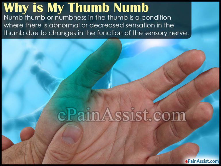 Why is My Thumb Numb & What is its Treatment?