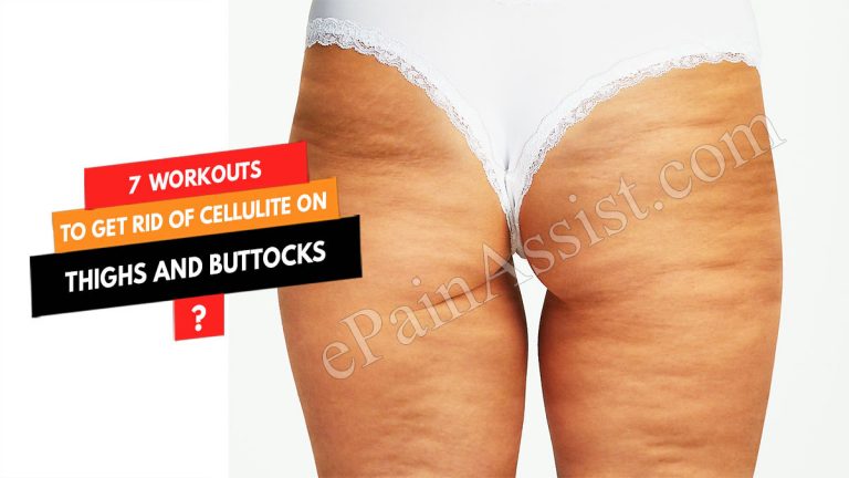 7 Workouts to Get Rid of Cellulite on Thighs and Buttocks