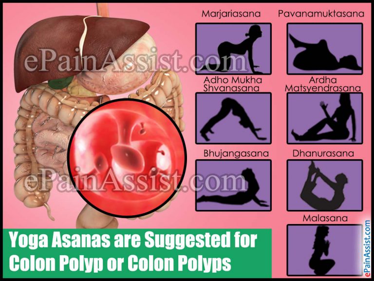 Colon Polyps: Exercises, Yoga, Recovery, Diet, Prevention