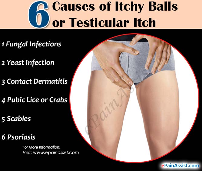 6 Causes of Itchy Balls or Testicular Itch