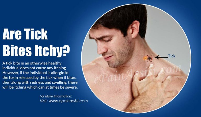 Are Tick Bites Itchy & Do They Swell?