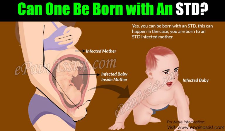 Can One Be Born with An STD?