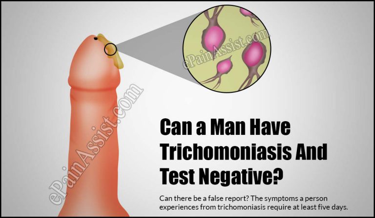 Can a Man Have Trichomoniasis And Test Negative?