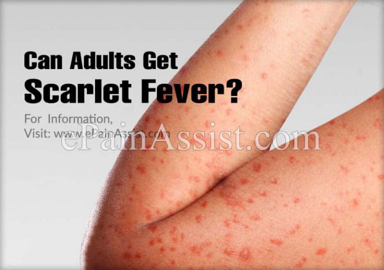 Can Adults Get Scarlet Fever?