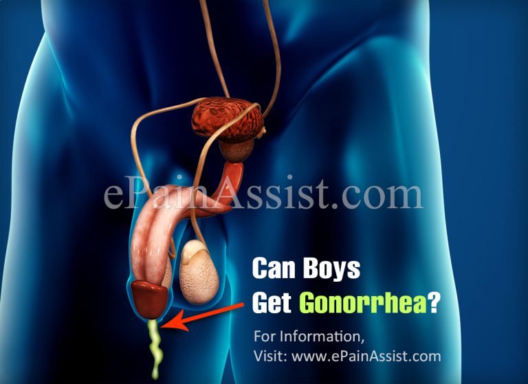 Can Boys Get Gonorrhea?