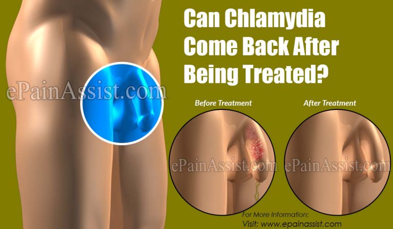 Can Chlamydia Come Back After Being Treated?