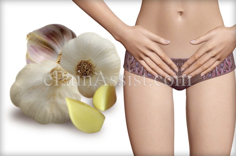 Can Garlic Cure Chlamydia?