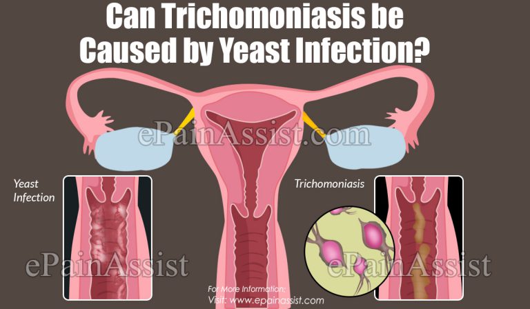 Can Trichomoniasis be Caused by Yeast Infection?