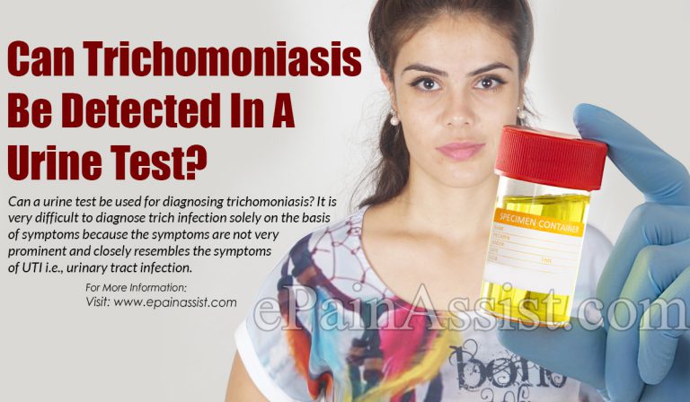 Can Trichomoniasis Be Detected In A Urine Test?