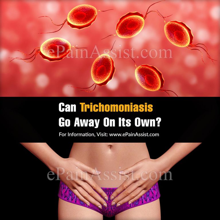 Can Trichomoniasis Go Away On Its Own?