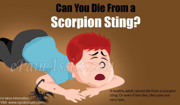 Can You Die from a Scorpion Sting?