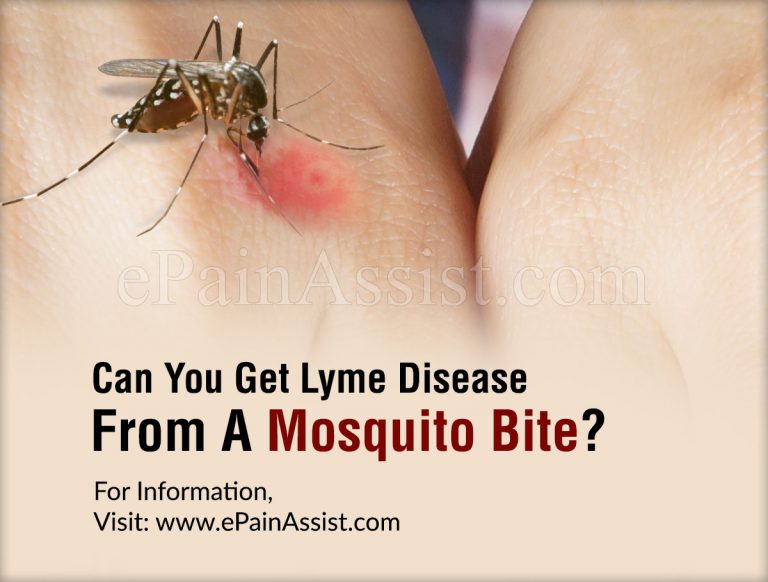 Can You Get Lyme Disease From A Mosquito Bite?