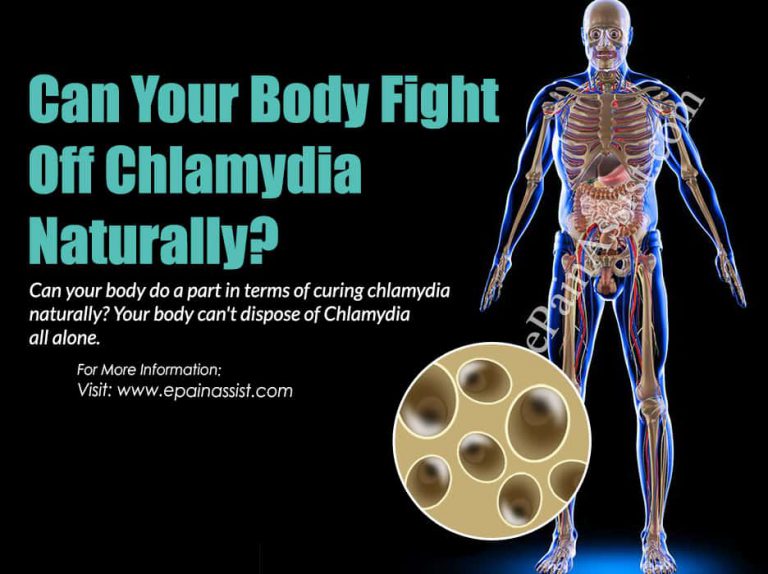 Can Your Body Fight Off Chlamydia Naturally?