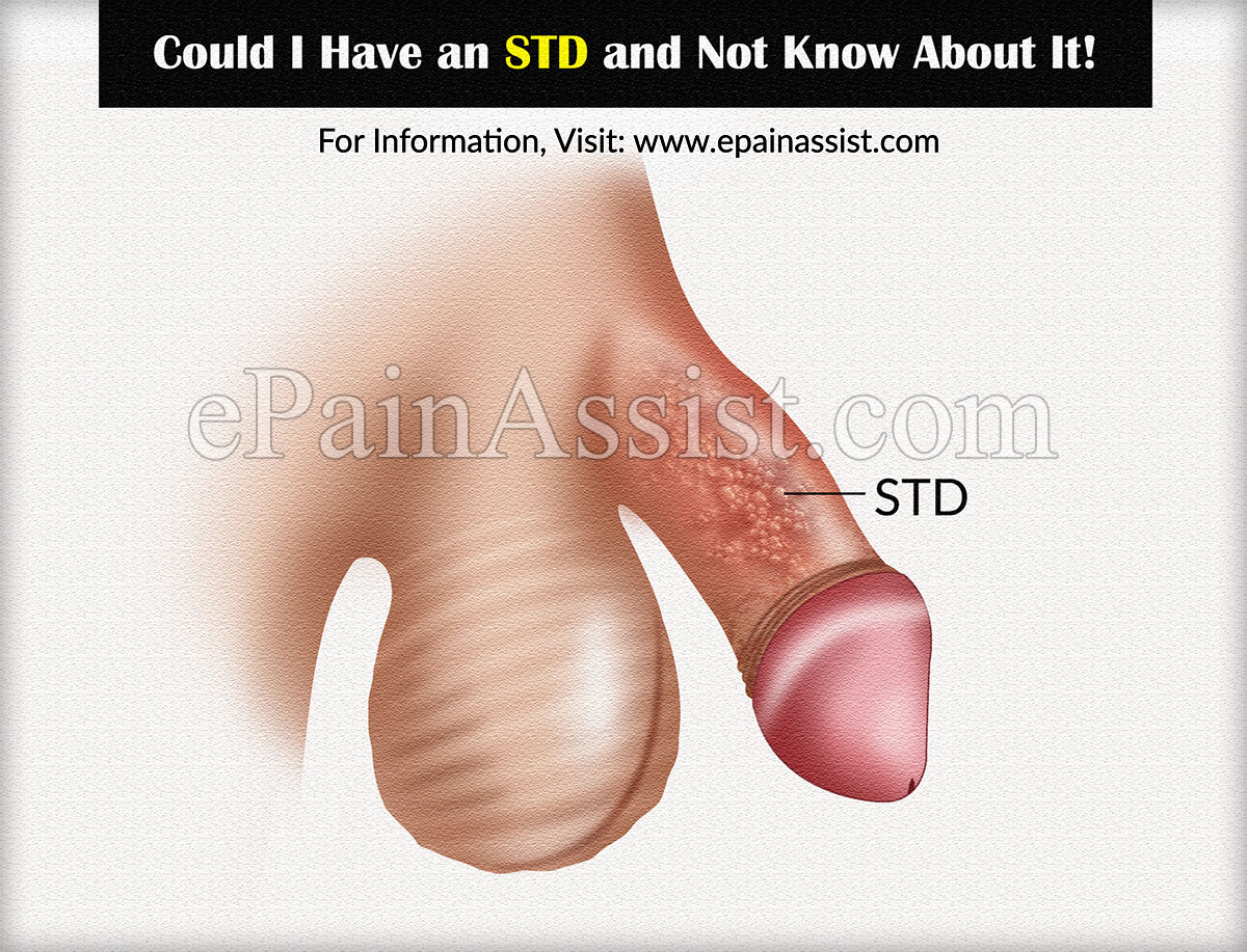 Could I Have an STD and Not Know About It?!