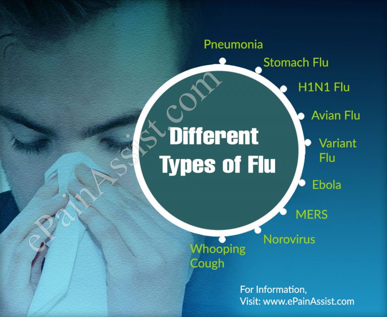 Different Types of Flu & Their Symptoms