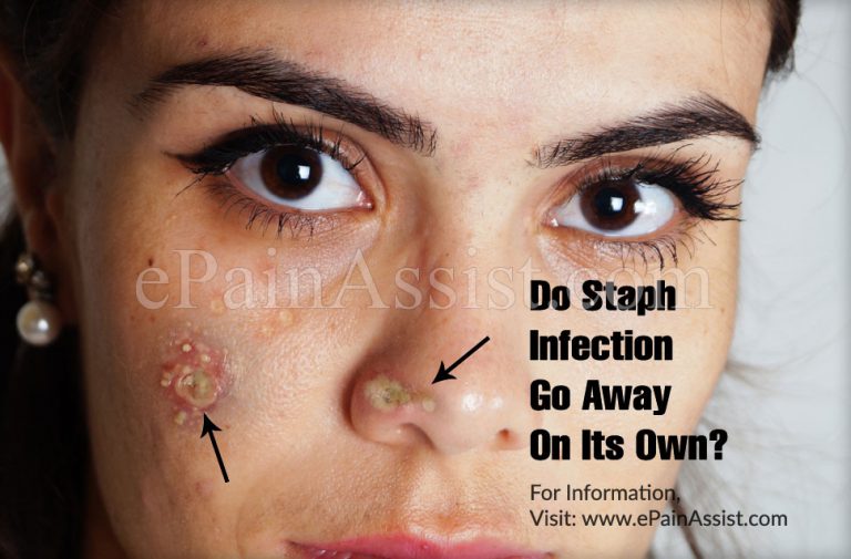 Do Staph Infection Go Away On Its Own & How Long Does It Take To Recover From It?