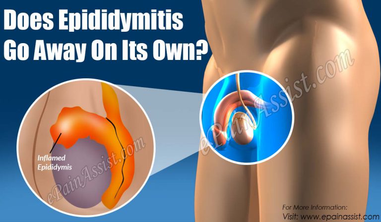 Does Epididymitis Go Away On Its Own?|Long Term Effects of Epididymitis