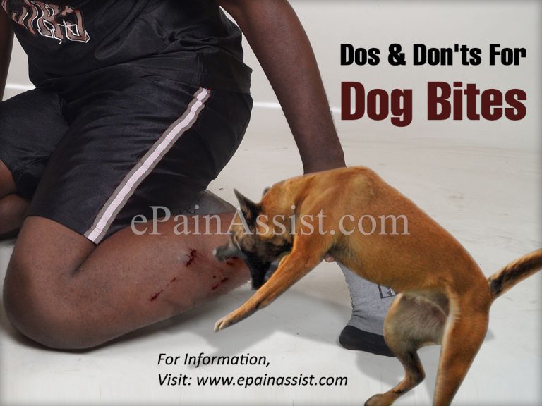 Dos & Don’ts For Dog Bites