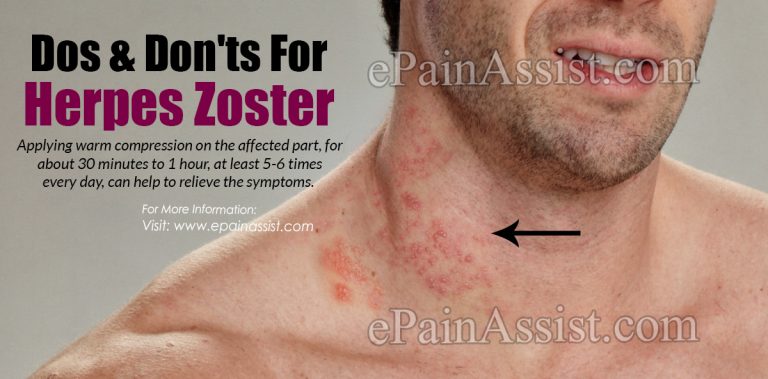Dos & Don’ts For Herpes Zoster