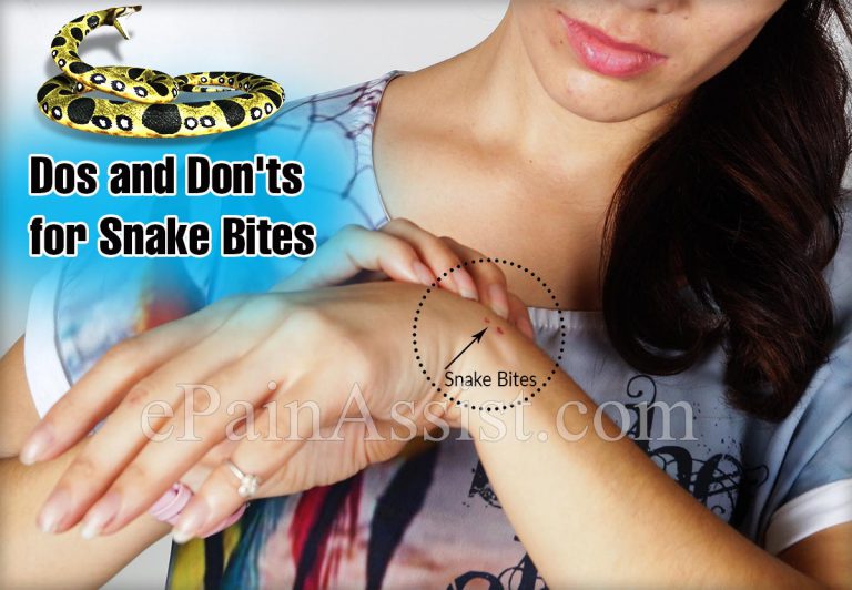 Dos and Don’ts for Snake Bites