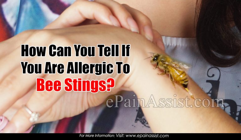 How Can You Tell If You Are Allergic To Bee Stings?