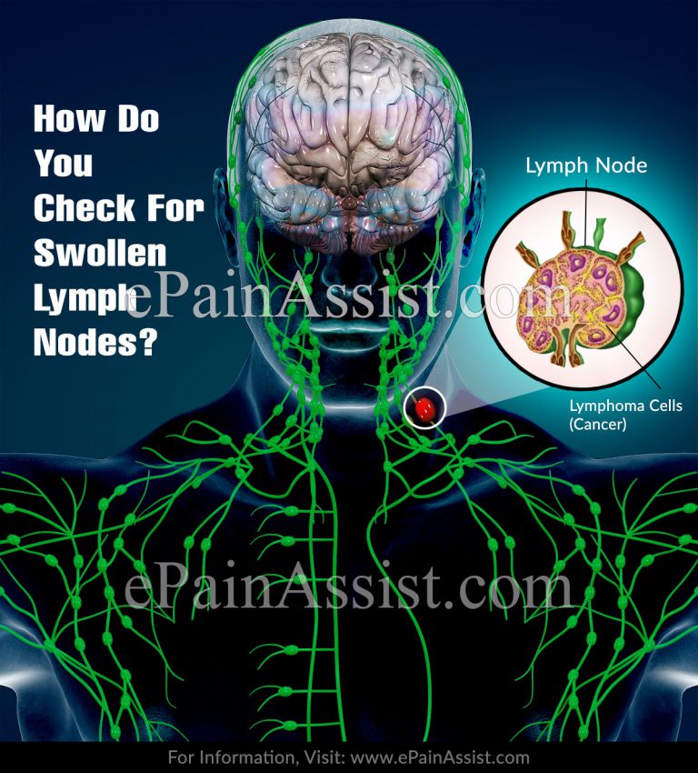 How Do You Check For Swollen Lymph Nodes?