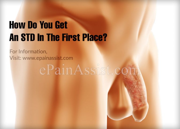 How Do You Get An STD In The First Place?