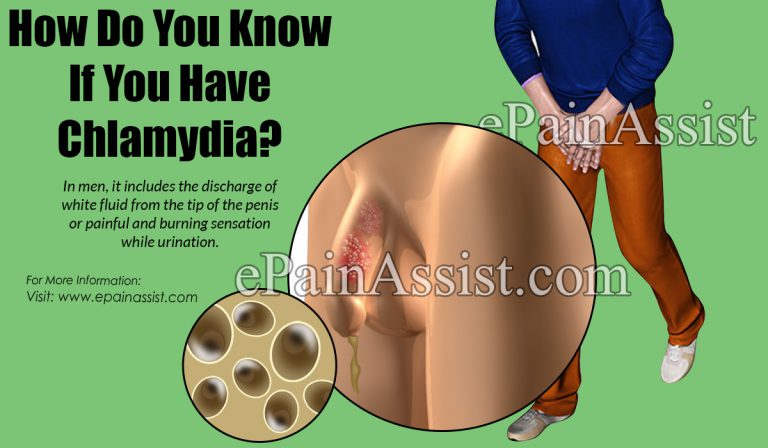 How Do You Know If You Have Chlamydia?