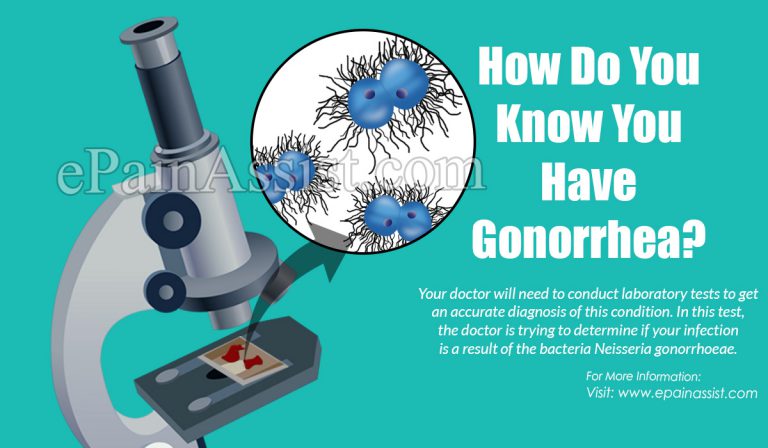 How Do You Know You Have Gonorrhea?