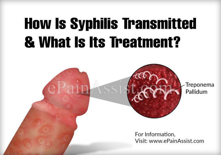 How Is Syphilis Transmitted & What Is Its Treatment?