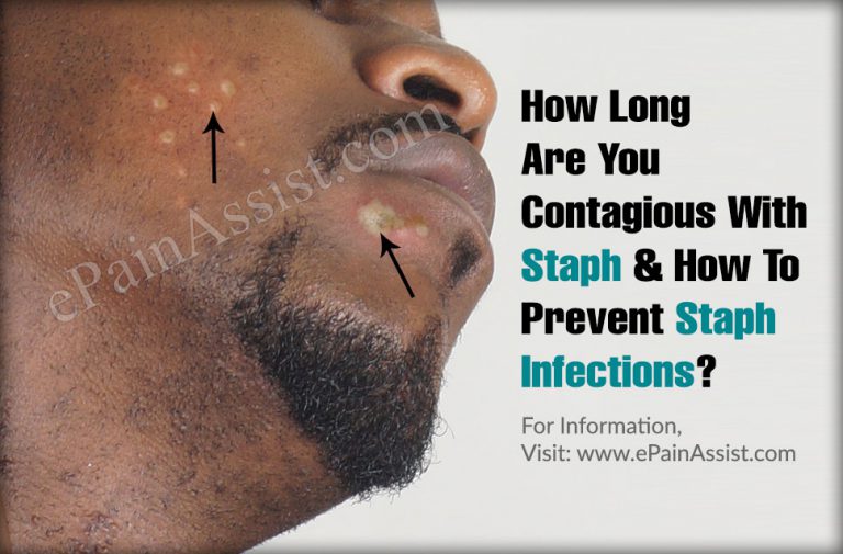 How Long Are You Contagious With Staph & How To Prevent Staph Infections?
