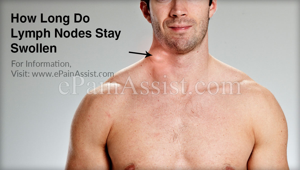 How Long Do Lymph Nodes Stay Swollen?