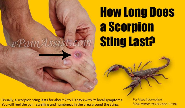 How Long Does a Scorpion Sting Last & what To Do If You Get Stung By a Scorpion