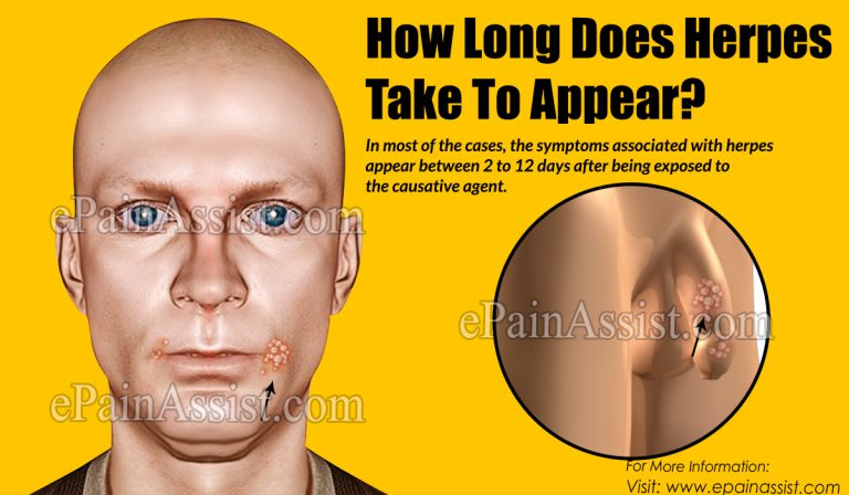 How Long Does Herpes Take To Appear & What are the Home Remedies to Manage Herpes?