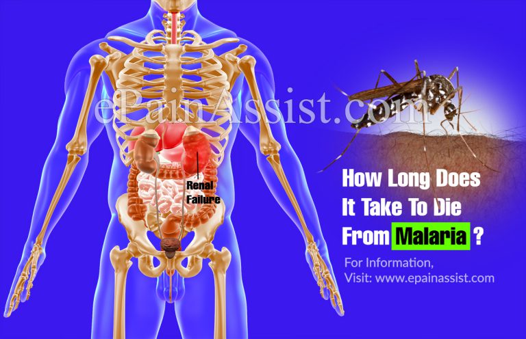 How Long Does It Take To Die From Malaria?