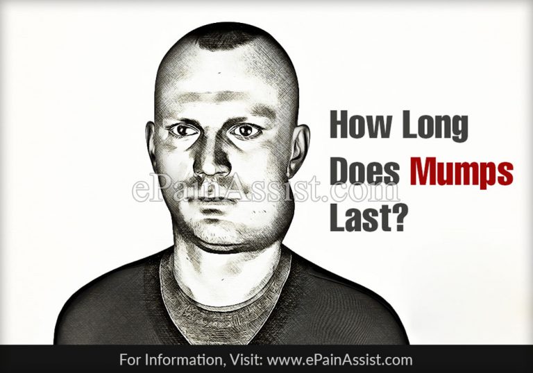 How Long Does Mumps Last, It’s Home Remedies, Prevention