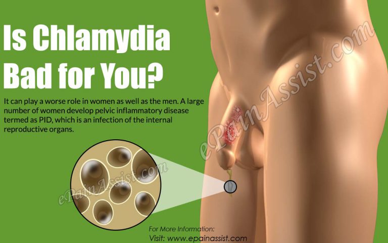 Is Chlamydia Bad for You?