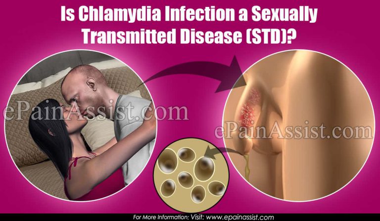 Is Chlamydia Infection a Sexually Transmitted Disease (STD)?