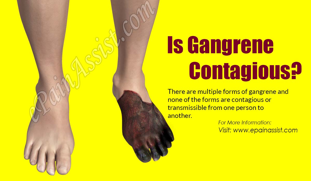 Is Gangrene Contagious?