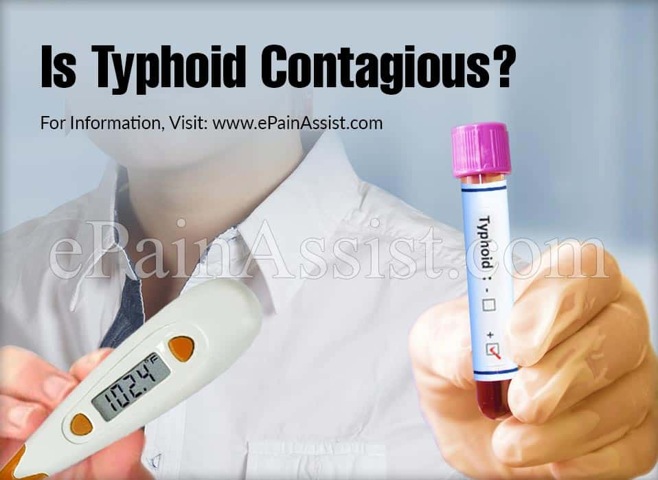 Is Typhoid Contagious?