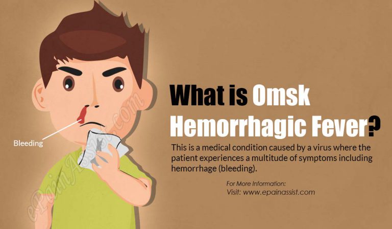 Omsk Hemorrhagic Fever: Causes, Symptoms, Treatment, Transmission, Incybation Period, Risk Factors, Complications, Prevention