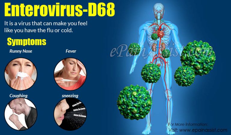 Enterovirus- D68( EV-D68): Symptoms & Treatments